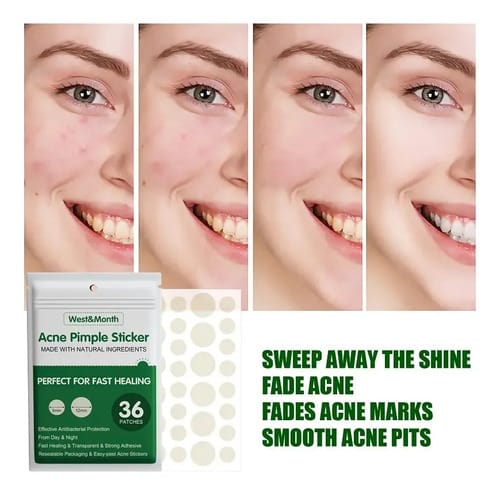 Suero Anti Acne Bioaqua 30ml - Ml Tipo De Piel Todo Tipo De Piel Día/noche
