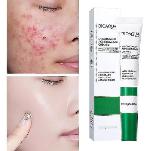 Crema Ácido Salicílico Bioaqua Control Acné Piel Grasa Grasa