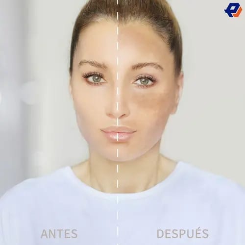Azelaic Acid Suspension 10% 30m Grasa