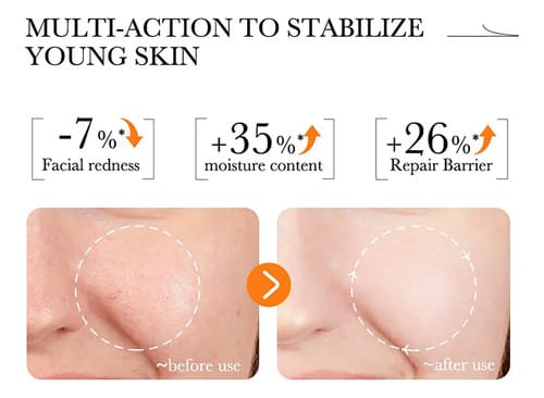 Serum Facial Vitamina C Antioxidante Brillo Antiacne Bioaqua Todo Tipo De Piel Día