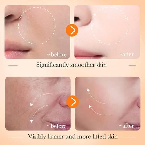Suero Facial Vitamina C Bioaqua 30 Ml Todo Tipo Piel Todo Tipo De Piel Día