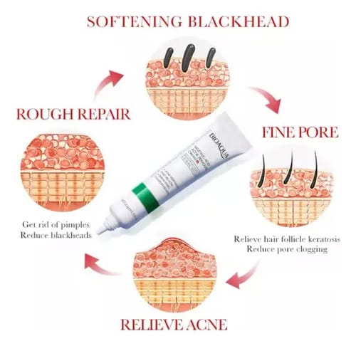 Crema Ácido Salicílico Bioaqua Control Acné Piel Grasa