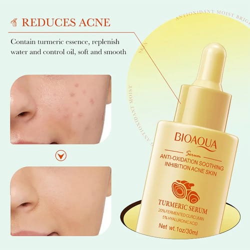 Set 3 Serum Facial Nicontinamida Curcuma Caracol Bioaqua Todo Tipo De Piel Día/noche