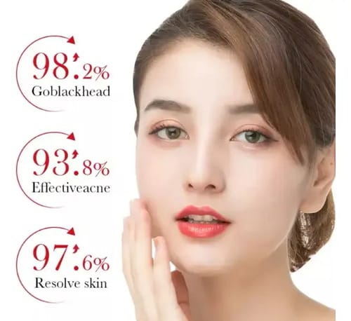 Crema Ácido Salicílico Bioaqua Control Acné Piel Grasa Grasa