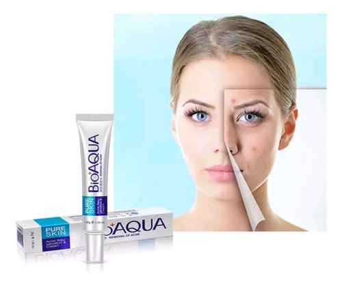 La Crema Secativa Para El Acné Bioaqua Elimina Las Cicatrices Del Acné Y Las Espinillas. Hora De Aplicación: Día/noche, Tipo De Piel Grasa