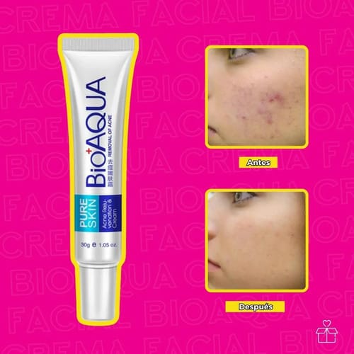 La Crema Secativa Para El Acné Bioaqua Elimina Las Cicatrices Del Acné Y Las Espinillas. Hora De Aplicación: Día/noche, Tipo De Piel Grasa