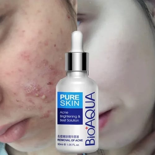 Suero Anti Acne Bioaqua 30ml Todo Tipo De Piel Día/noche