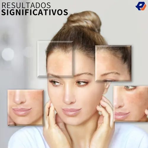 Azelaic Acid Suspension 10% 30m Grasa