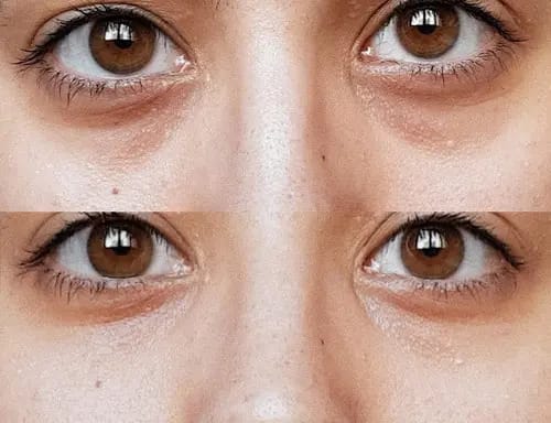 Sérum The Ordinary Cafeína 5% Contorno De Ojos Bolsa Ojeras 30ml Todo Tipo De Piel Día/noche