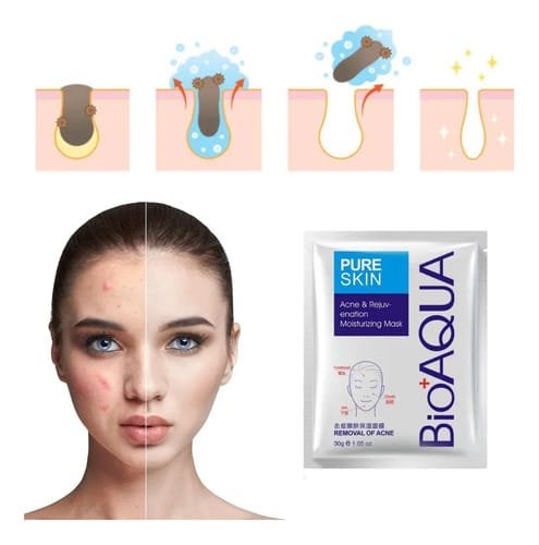 Kit X6 Velo Mascarilla Bioaqua Acne Control Acne Remover Todo Tipo De Piel
