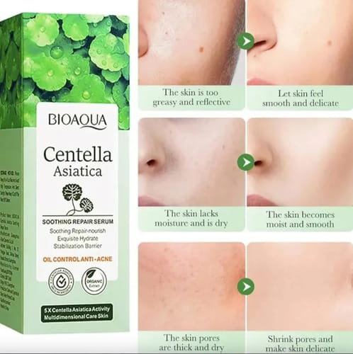 Serum Control Oil Anti Acné Centella Asiática Bioaqua Todo Tipo De Piel Día/noche