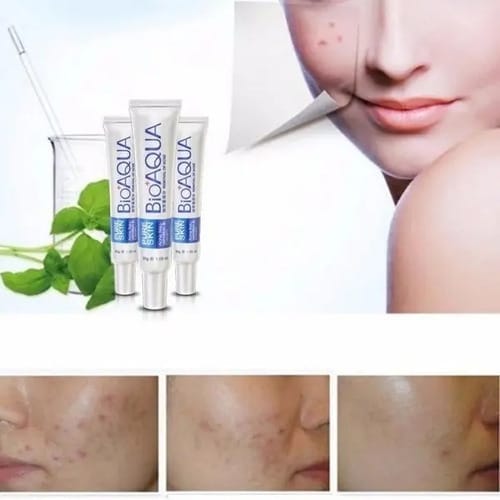 La Crema Secativa Para El Acné Bioaqua Elimina Las Cicatrices Del Acné Y Las Espinillas. Hora De Aplicación: Día/noche, Tipo De Piel Grasa