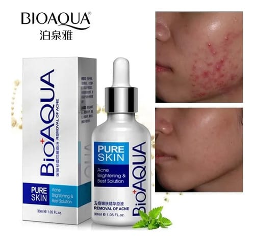 Suero Anti Acne Bioaqua 30ml Todo Tipo De Piel Día/noche